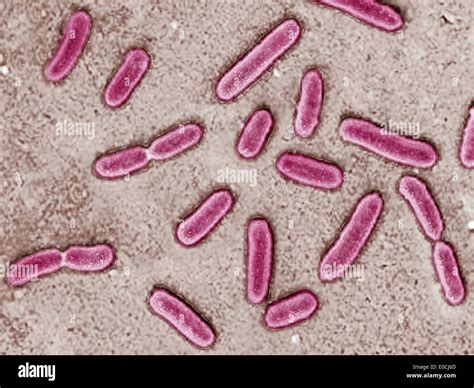 Pseudomonas Aeruginosa Fotografías E Imágenes De Alta Resolución Alamy