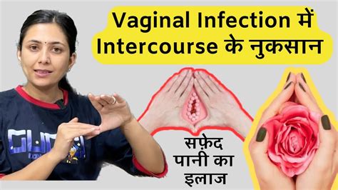 Vaginal Fungal Infection Days Challenge Vaginal Tightening