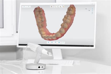 Digital Impression System Phoenix Az Carefree Smiles Dentistry