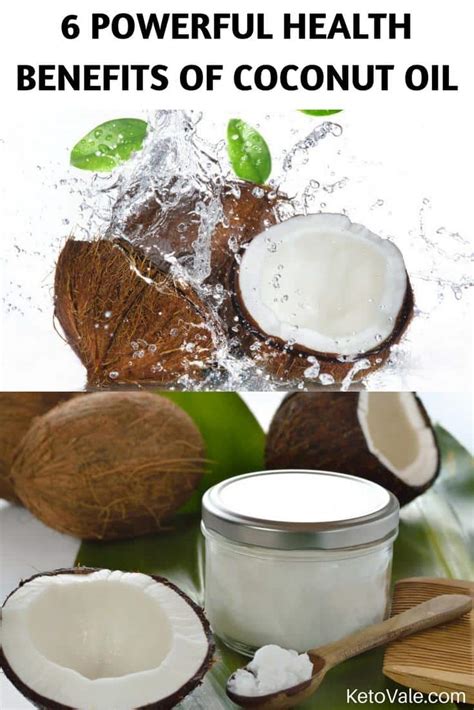 6 Powerful Health Benefits Of Coconut Oil