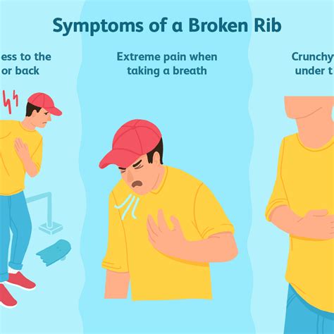 Broken Rib Causes Signs Symptoms Recovery Time Treatm