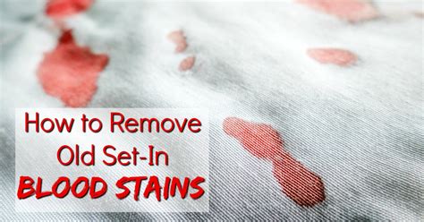 How To Remove Dried Set In Blood Stains From Clothes