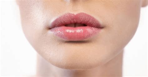 Since fillers are now used in so many kinds of aesthetic treatments, such as the filling of wrinkles, the correction of asymmetries or scarring, volume replacement, contouring, and rejuvenation. How to care for your lips after dermal filler | Australian ...