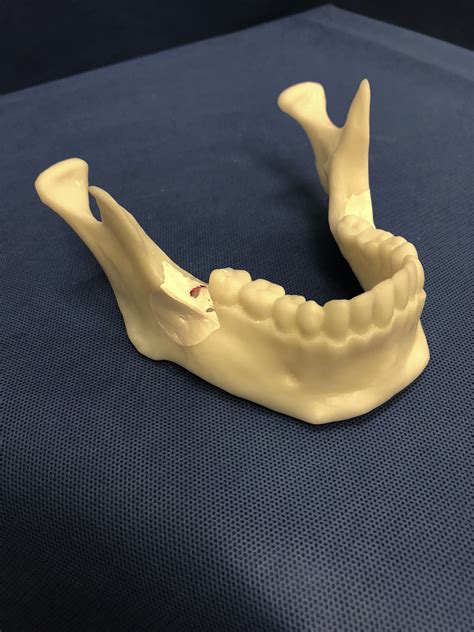 Physical Simulation Models In Oral And Maxillofacial Surgery A New