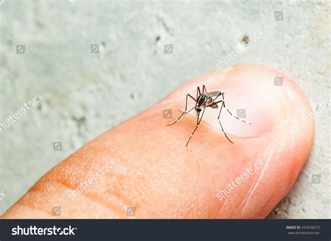 Aedes Mosquito Bite On Skin Mosquito Stock Photo 433536673 Shutterstock