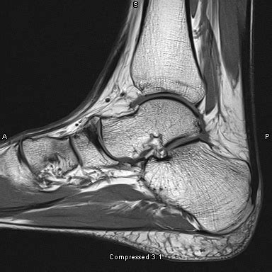 49 best images about Anatomy of the Ankle on Pinterest | Foot anatomy