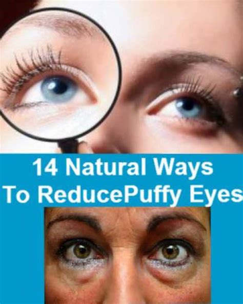 How To Fix Puffy Eyes Causes Best Solutions And Homemade Remedies
