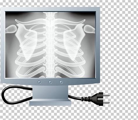 X Ray Clipart Clipground