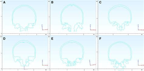 Frontiers Exposure Region Of The Kawase Approach And Its Correlation