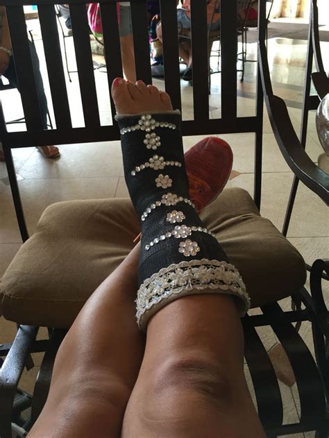 76 Best Awesome Casts Images On Pinterest Broken Leg Broken Foot And