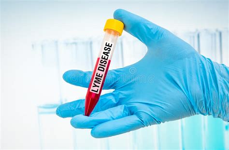 Test Tube With Blood Sample For Lyme Disease Test Stock Photo Image