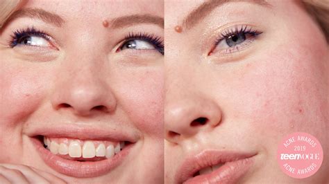 How To Get A Zit Surface » Stupiddemand