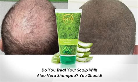 If properly soaked for 12 to 14 hours, reetha will be soft to the touch. Why is Aloe Vera for Hair Growth so Effective? | Aloe vera ...