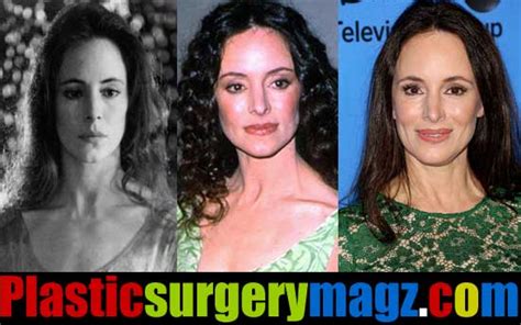 Madeleine Stowe Plastic Surgery Before And After Plastic Surgery Magazine