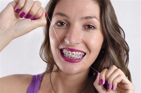 How To Floss Your Teeth With Braces
