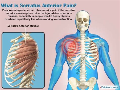 Serratus Anterior Muscle Function Pain Causes And My Xxx Hot Girl