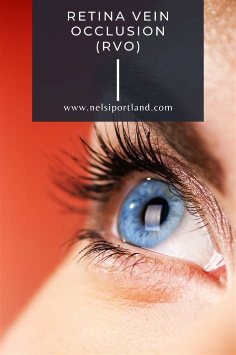Prk Vision Correction At Northwest Eye Laser Institute Nelsi An Ophthalmologyeye Care