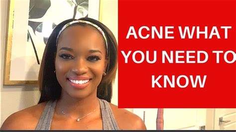 ACNE TREATMENT | ACNE REMOVAL - YouTube