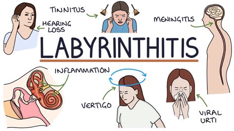 Understanding Labyrinthitis Youtube