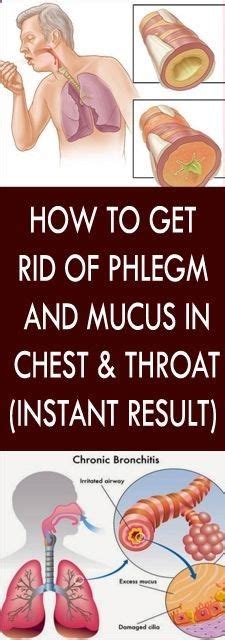 How To Get Rid Of Phlegm And Mucus In Chest Throat Instant Result