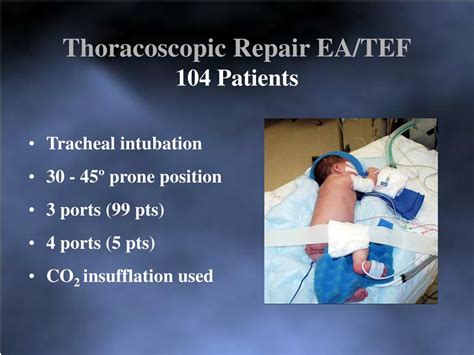 ppt thoracoscopic repair of esophageal atresia with tracheoesophageal fistula powerpoint