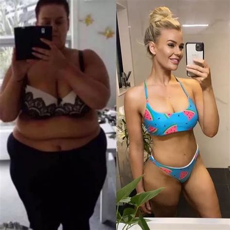 Woman 29 Shows Off Incredible Body After Massive 14st Weight Loss And Skin Surgery Daily Star