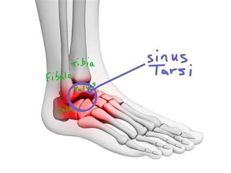 Posts About Swelling On Walkwellstaywell Sinusitis Left Ankle
