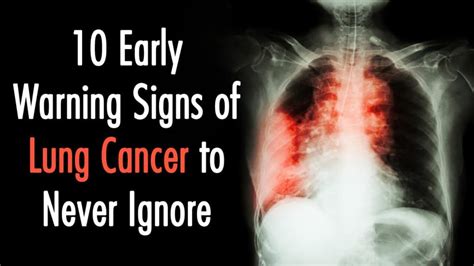Early Signs Of Lung Cancer My XXX Hot Girl