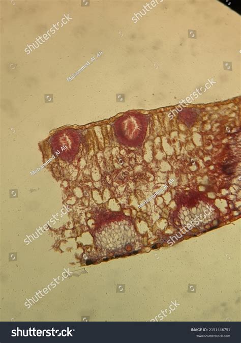 Photo Under Microscope Fungi Growth On Stock Photo 2151446751