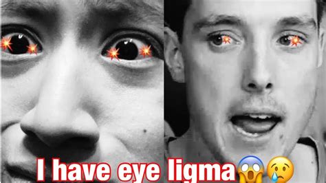 Me And Lazarbeam Have Eye Ligma⁉️ Youtube