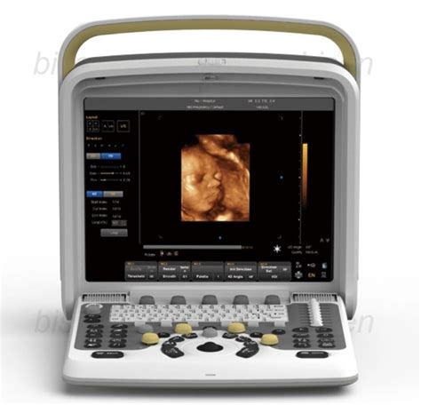 Chison Q5 Portable 3d4d Color Doppler Obgyn Ultrasound Machine At