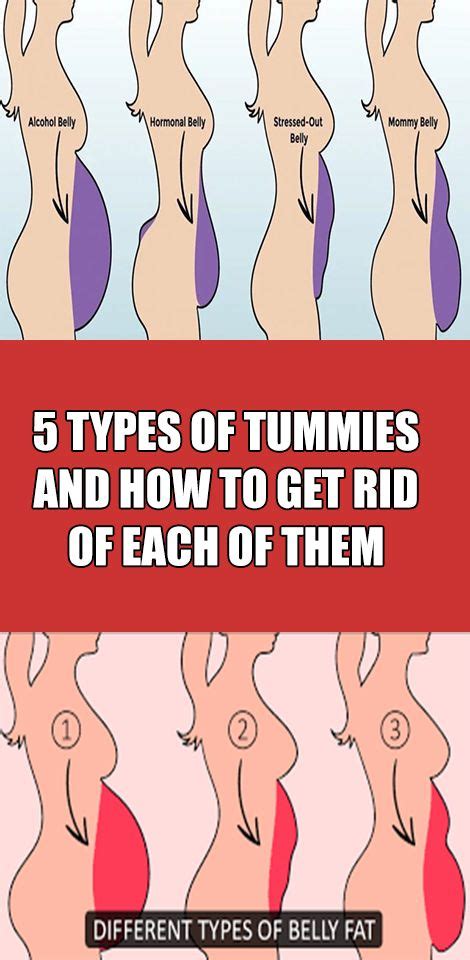 5 Types Of Tummies And How To Get Rid Of Each Of Them Gezond