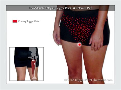 Adductor Trigger Points: The PMS Trigger Point | TriggerPointTherapist.com