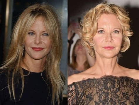Meg Ryan Before And After Plastic Surgery Face Nose Lips