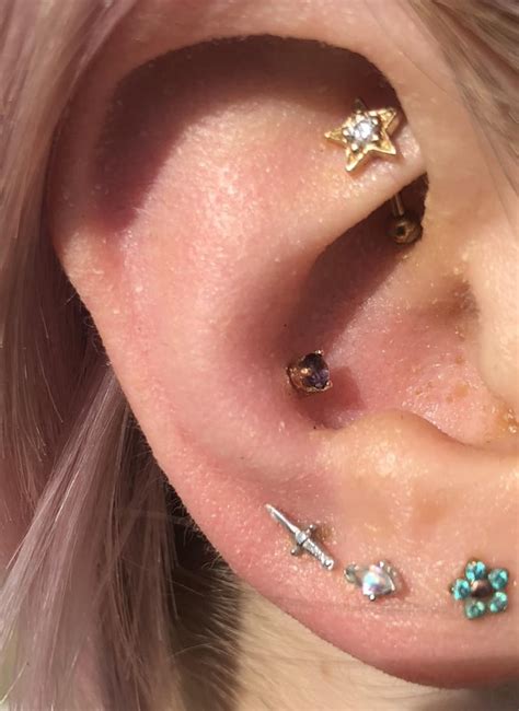 Conch Really Irritated Help Rpiercing