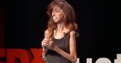 Meet The World S Ugliest Woman Who Is A Motivational Speaker Photos Sexiz Pix