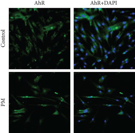 PM Induced The Nuclear Translocation Of AhR And Upregulated CYP1A1