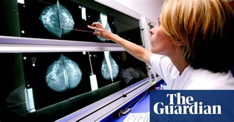 Uk Cancer Patients Could Contribute £32bn To Gdp By 2030 With Better