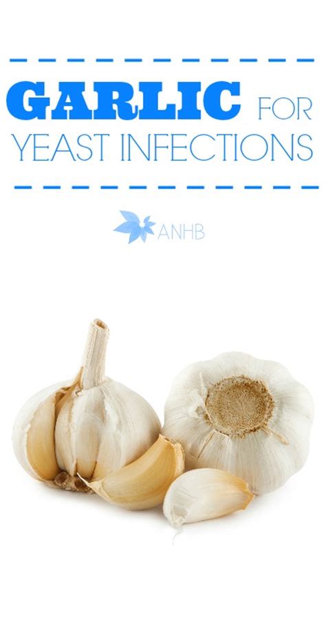 Natural Yeast Infection Remedy Using Garlic Updated For 2018