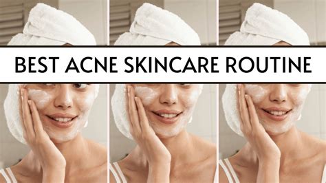 The Lazy Easy Acne Skincare Routine Youll Ever Try 2021