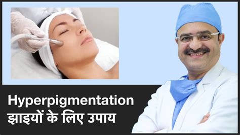 Treatments For Hyperpigmentation झाइयों के लिए उपाय Part 3