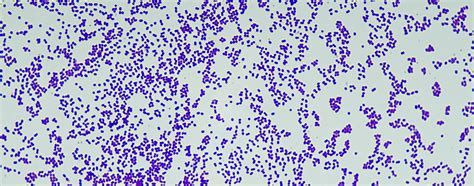 Its worth mentioning what the gram stain color means. Gram-positive molecular pathogenesis | Faculty of Medicine ...