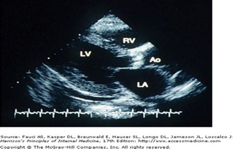 Cardio Echocardiography 1 And 2 Flashcards Quizlet