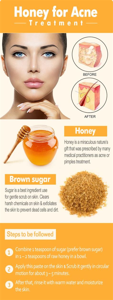 Homemade Acne Remedies Home Acne Remedies What You Need To Know For