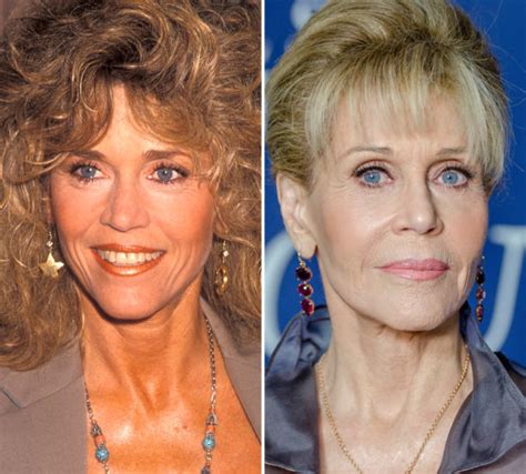 Jane Fonda Plastic Surgery Before And After Pictures 2022 Hot Sex Picture