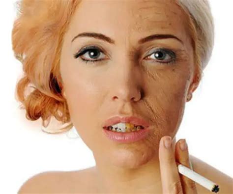 Effects Of Smoking On Skin Does Quitting Smoking Help Skin Smokers