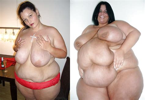 Weight Gain Before And After Part Pics Xhamster