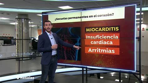 Miocarditis gran diccionario de la lengua española © 2016. El coronavirus puede provocar miocarditis y dejar secuelas ...
