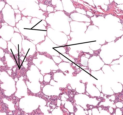 Alveoli Lung Tissue Histology Diagram Quizlet