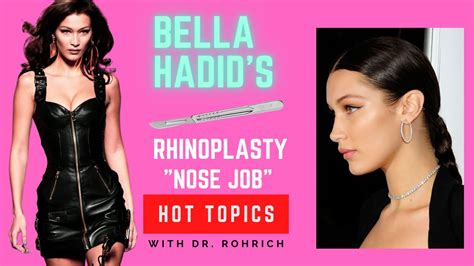 Hot Topics Bella Hadid S Rhinoplasty With Dr Rohrich YouTube
